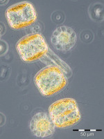 Bild 3: Porosira glacialis vom 17.3.2015