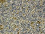 Image 2: Overview image of the sample from 20.3.2018, sample not evaluable.
