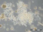 Image 5: Colonies of the Chrysophycee Dinobryon balticum from 31.3.2015