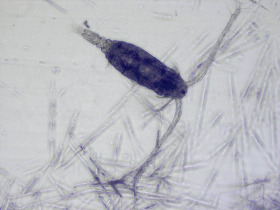 Mesozooplankton