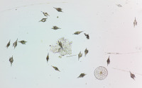 Mikroscope photo of a water sample with plankton from the Amazon river plume