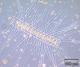 Kieselalge Chaetoceros decipiens