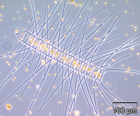 Chaetoceros decipiens