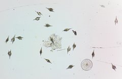 Amazonas-Plankton